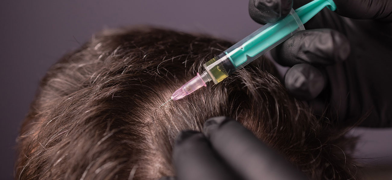 Exosome Hair Regeneration